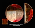 salmonella enterica